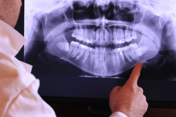 Best Broken or Cracked Tooth Emergency Dentist in Pine Castle, FL